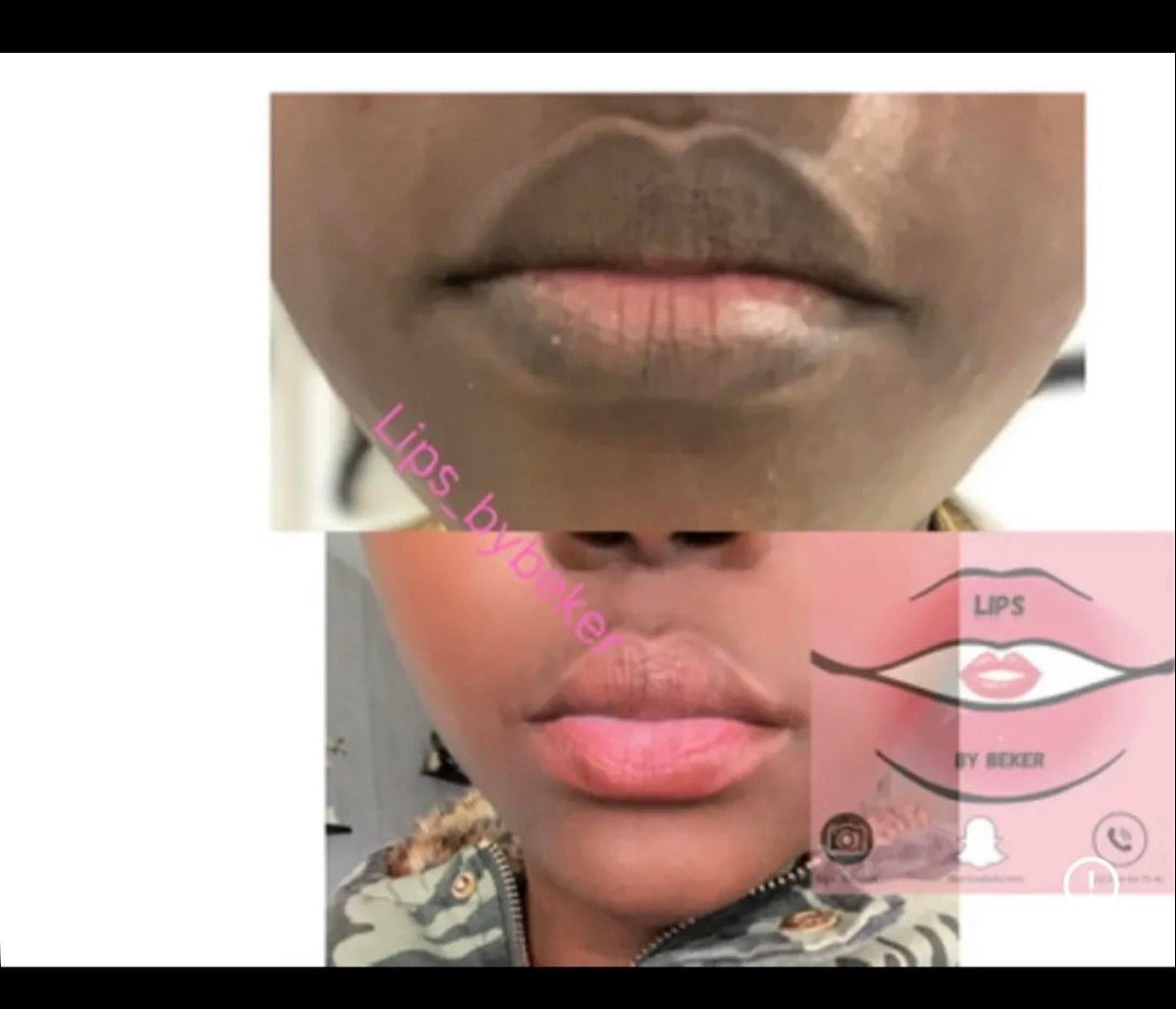 Kits Lèvres Roses : Taille M